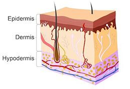 This diagram shows a cross section of skin with three horizontal layers. There are several long black hairs protruding from the topmost layer of the skin, with the root hairs embedded within the deepest layer of the skin. The epidermis is the topmost layer of the skin, which is the thinnest layer and is composed of multiple cell sheets tightly packed on top of each other. The middle layer of skin is labeled the dermis which is the thickest layer. The dermis occupies approximately one half of the skin cross section and contains blood vessels and nerves. The deepest layer is labeled the hypodermis and is about twice the thickness of the outermost layer. It contains several round, yellowish cells as well as an artery, a vein, and a nerve running horizontally through the entire layer. Branches from the blood vessels and nerves travel up to the dermis. A table underneath the image describes the cells in the different layers of skin. It states that epidermis is composed of layered sheets of tightly packed cells that divide readily and have a poor blood supply. The dermis has a good blood supply and contains the nerve endings. The hypodermis contains a layer of fatty tissue for cushioning, good blood supply, and nerves.