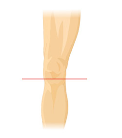 This figure shows an anterior view of the left knee. A horizontal red line cuts perpendicularly across the knee.